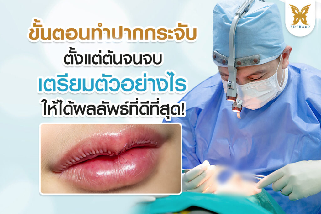 ขั้นตอนทำปากกระจับ ตั้งแต่การเตรียมตัวจนถึงการดูแลหลังผ่าตัด