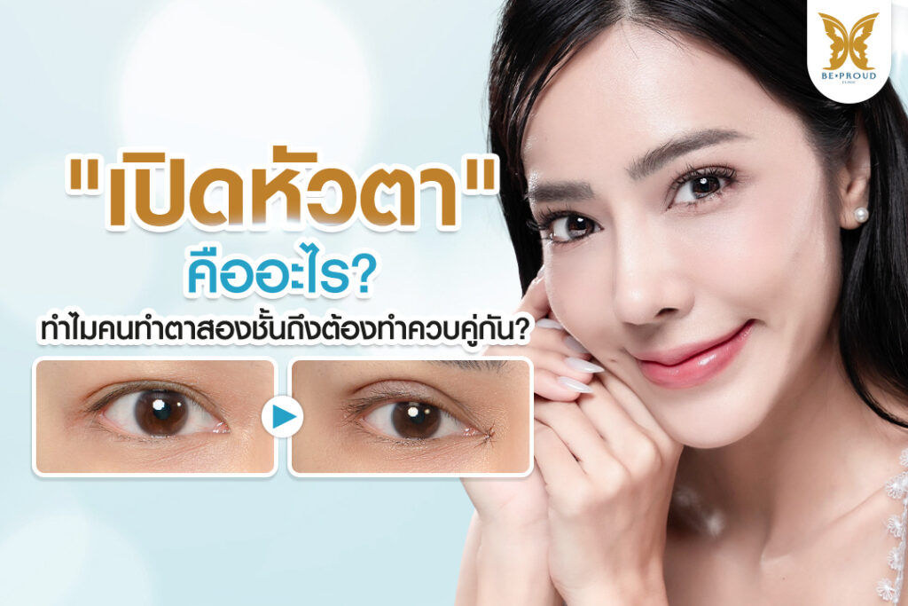 ภาพปกบทความเปิดหัวตาคืออะไร ทำไมต้องทำคู่กับตาสองชั้น