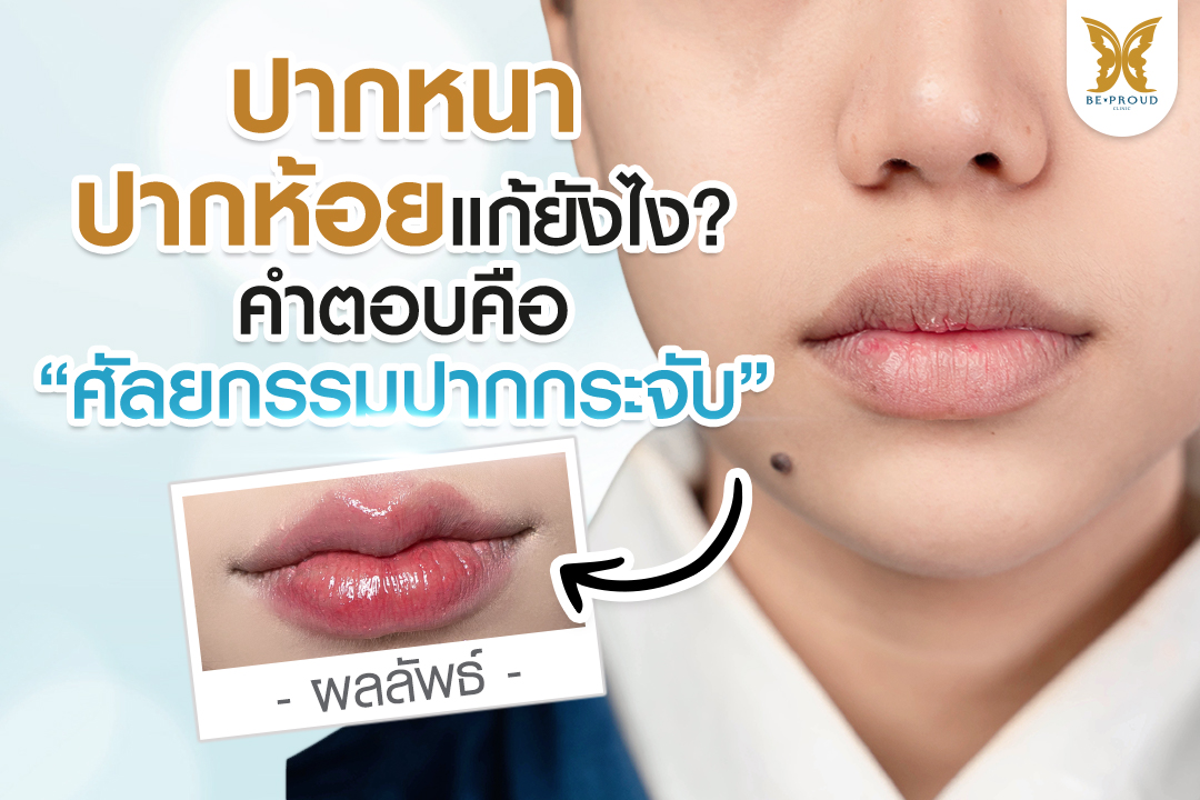ผู้หญิงปากหนา ปากห้อย ศัลยกรรมปากกระจับ แก้รูปปากให้บางสวย ได้สัดส่วน พร้อมผลลัพธ์ก่อนหลังทำ