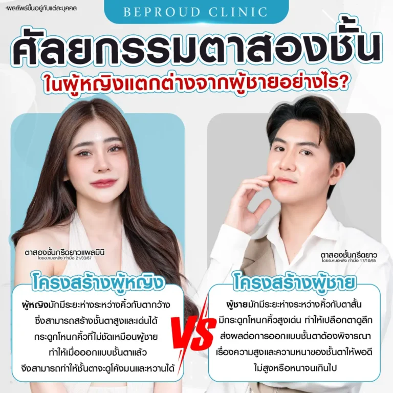 เทียบชัด! ศัลยกรรมตาสองชั้นผู้ชาย ต่างจาก ศัลยกรรมตาสองชั้นผู้หญิง อย่างไร?
