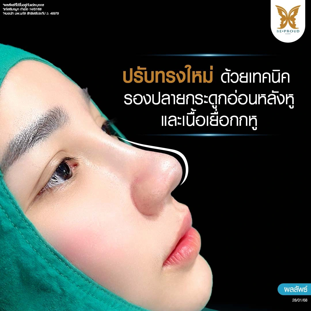 เจ๊ตับฉ่ำโบ๊ะ ปรับทรงจมูกกับหมอนัท เทคนิคกระดูกอ่อนหลังหูและเนื้อเยื่อกกหู