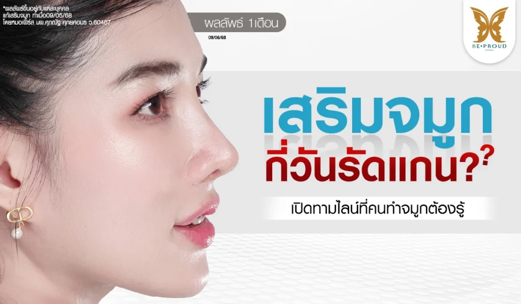 เสริมจมูกกี่วันรัดแกน? เช็กไทม์ไลน์ยุบบวมพร้อมรีวิวผลลัพธ์หลังเสริมจมูกครบ 1 เดือน ดูแลโดยหมอเฟิร์ส นพ.ศุภณัฐ บีพราวด์ คลินิก ( Beproud Clinic )