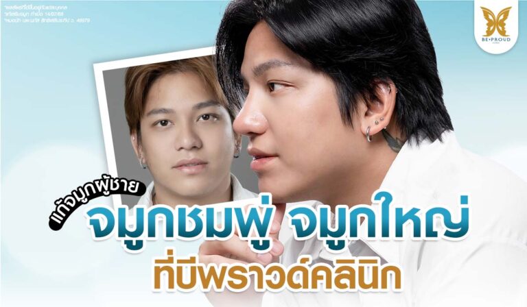 แก้จมูกผู้ชาย จมูกชมพู่ จมูกใหญ่ ที่บีพราวด์คลินิก