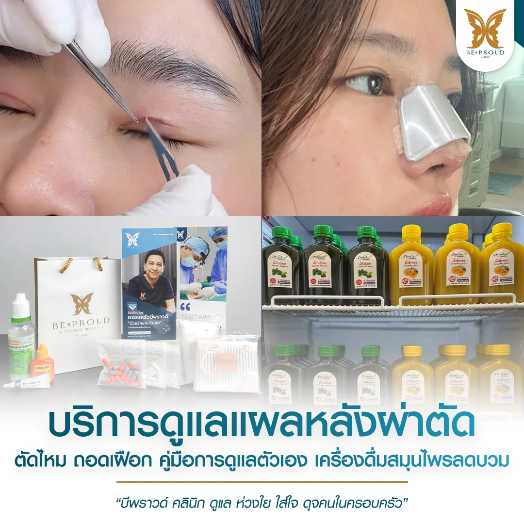 รวมบริการดูแลหลังผ่าตัดศัลยกรรมจมูกที่ บีพราวด์ คลินิก การตัดไหมโดยผู้ชำนาญการ, การถอดเฝือกจมูก, ชุดยาและคู่มือดูแลตัวเอง และเครื่องดื่มสมุนไพรลดบวม บริการดูแลแผลหลังผ่าตัด ดูแล ห่วงใย ใส่ใจ ดุจคนในครอบครัว