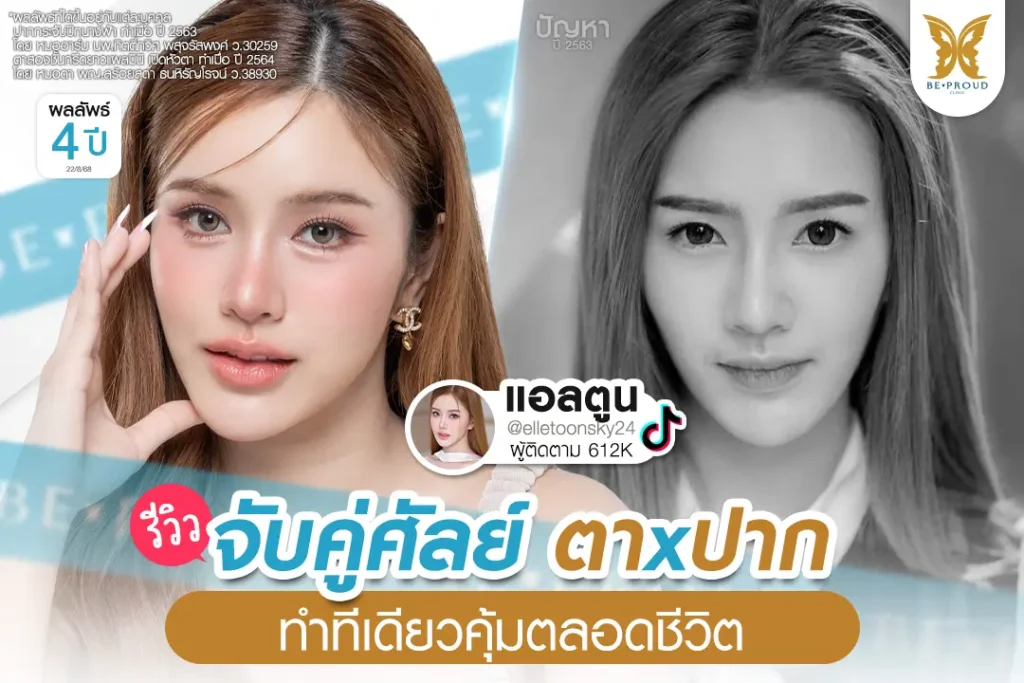 เปิดหางตา กดตาล่าง รีวิวเปิดหางตา กดตาล่าง ให้ตากลมแบ๊ว ฉบับทำที่ไทย