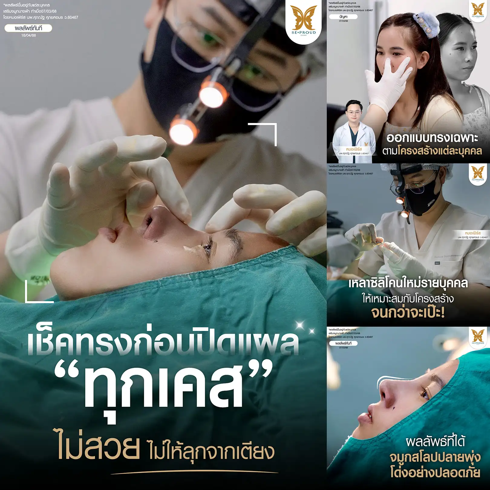 ขั้นตอนการเสริมจมูกที่ใส่ใจทุกรายละเอียดของ บีพราวด์ คลินิก ตั้งแต่การออกแบบทรงตามโครงสร้าง, การเหลาซิลิโคนใหม่รายบุคคล, การเช็กทรงก่อนปิดแผลทุกเคส และผลลัพธ์จมูกสโลปปลายพุ่ง ไม่สวย ไม่ให้ลุกจากเตียง