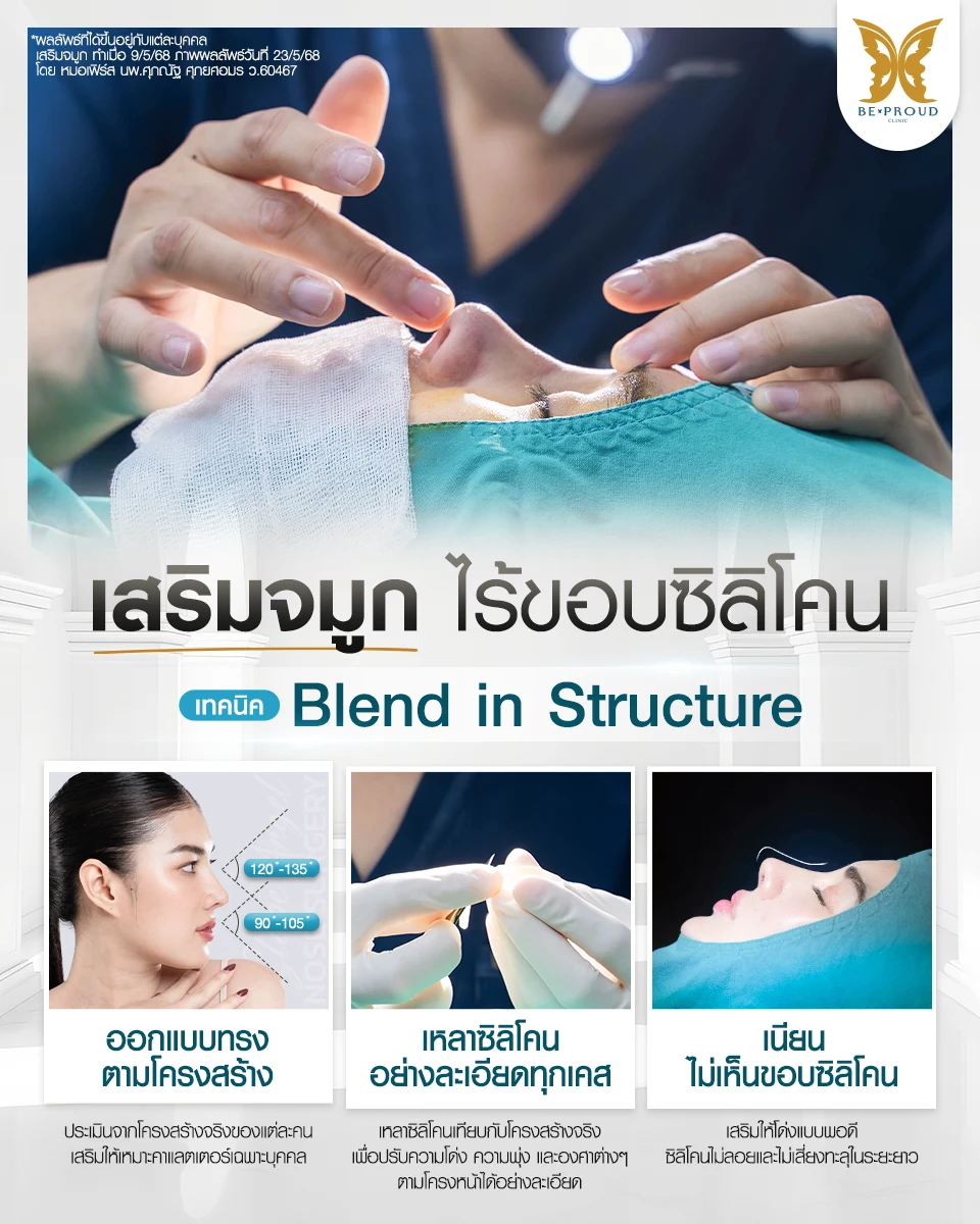 เทคนิคพิเศษของ บีพราวด์ คลินิก ขั้นตอนการออกแบบทรงตามโครงสร้าง การเหลาซิลิโคนอย่างละเอียดทุกเคส และผลลัพธ์จมูกเนียนไม่เห็นขอบซิลิโคน เพื่อให้ได้ทรงสโลปปลายพุ่งที่เป็นธรรมชาติ