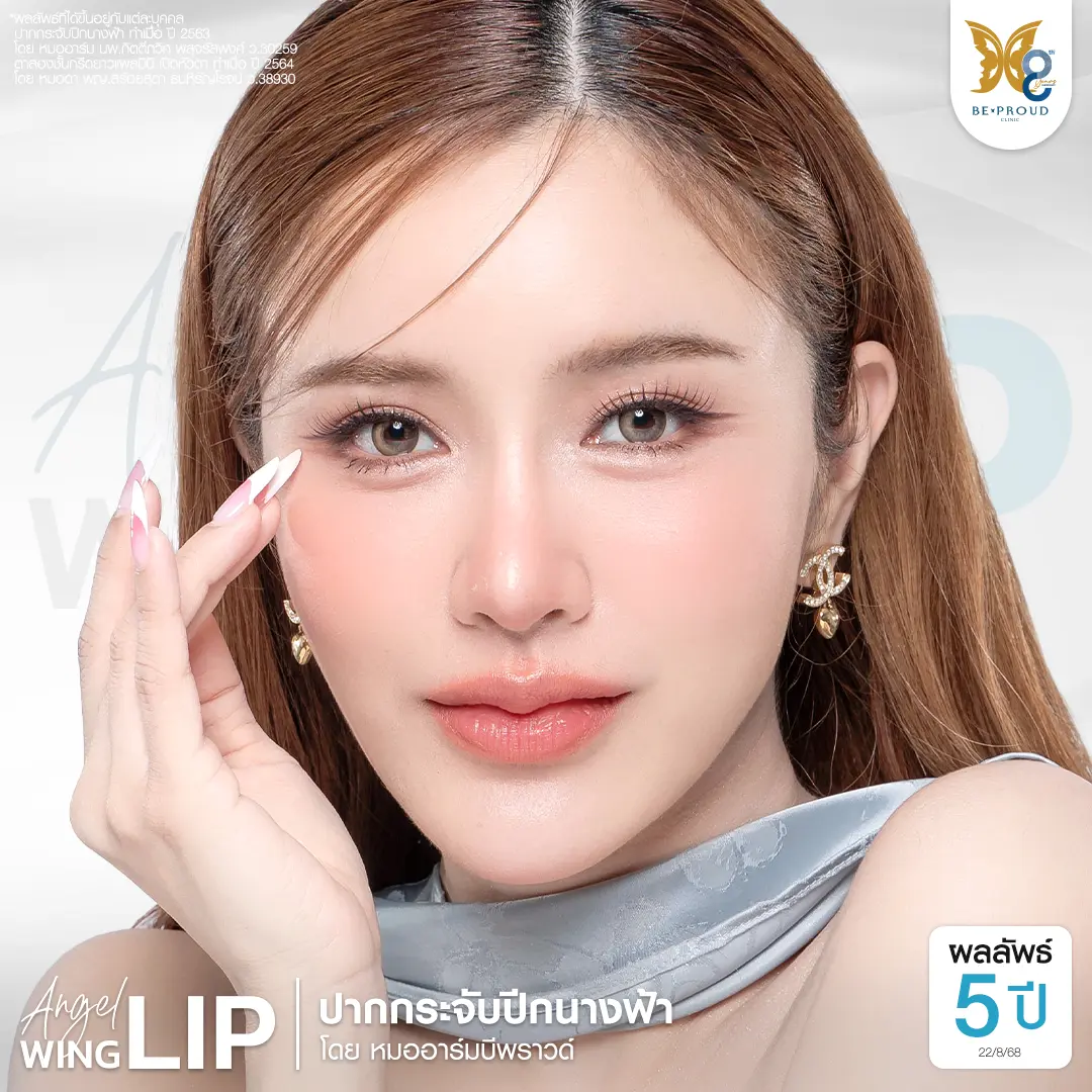 รีวิวผลลัพธ์ตาสองชั้นเทคนิค Mini Angel Eyelid ครบ 4 ปี โดยหมอดา บีพราวด์คลินิก ชั้นตาคมชัด แผลมินิ สวยหวานเป็นธรรมชาติ