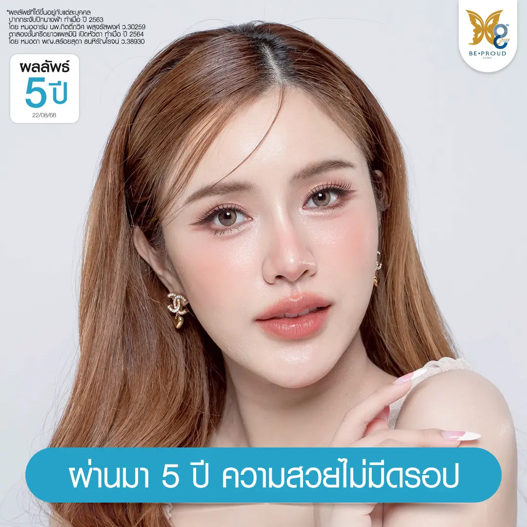 รีวิวผลลัพธ์ตาสองชั้นเทคนิค Mini Angel Eyelid ครบ 4 ปี โดยหมอดา บีพราวด์คลินิก ชั้นตาคมชัด แผลมินิ สวยหวานเป็นธรรมชาติ