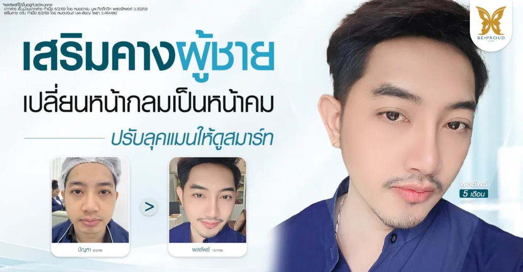 เสริมคาง ผู้ชาย เปลี่ยนหน้ากลมเป็นหน้าคม ปรับลุคแมนให้ดูสมาร์ท