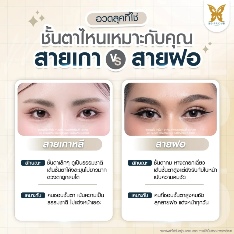 เปรียบเทียบตาสองชั้นสายเกาหลี VS สายฝอ ทรงไหนที่ใช่และเหมาะกับรูปหน้าคุณ | Beproud Clinic