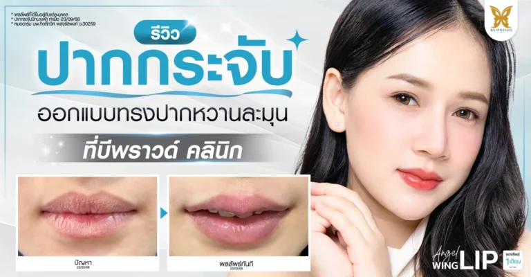 รีวิวปากกระจับ ออกแบบทรงปากหวานละมุน เทคนิคปีกนางฟ้า โดยหมออาร์ม Beproud Clinic