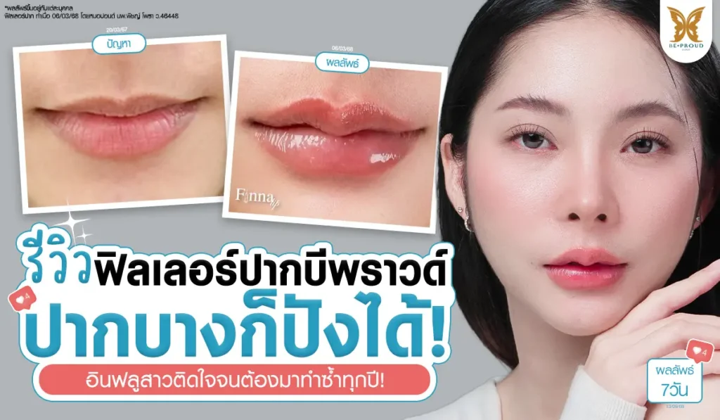 ภาพรีวิวผลลัพธ์การฉีดฟิลเลอร์ปากของคุณอีฟ ที่ บีพราวด์ คลินิก โดยหมอปอนด์ ผลลัพธ์ริมฝีปากที่อวบอิ่ม ทรงสวย อินฟลูสาวติดใจจนต้องมาทำซ้ำทุกปี
