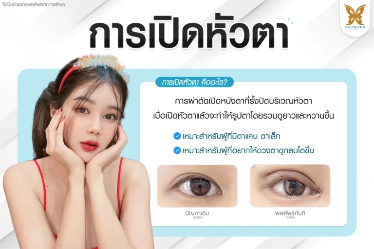 เทคนิคเปิดหัวตา ปรับรูปตาเรียวยาวกลมโตดูหวานละมุน | Beproud Clinic