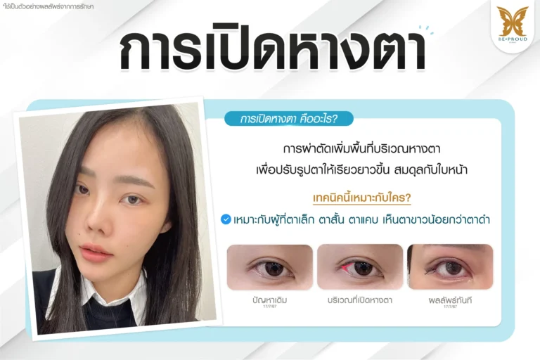 เทคนิคเปิดหางตา ปรับรูปตาให้เรียวยาวดูสมดุลรับกับใบหน้า Beproud Clinic