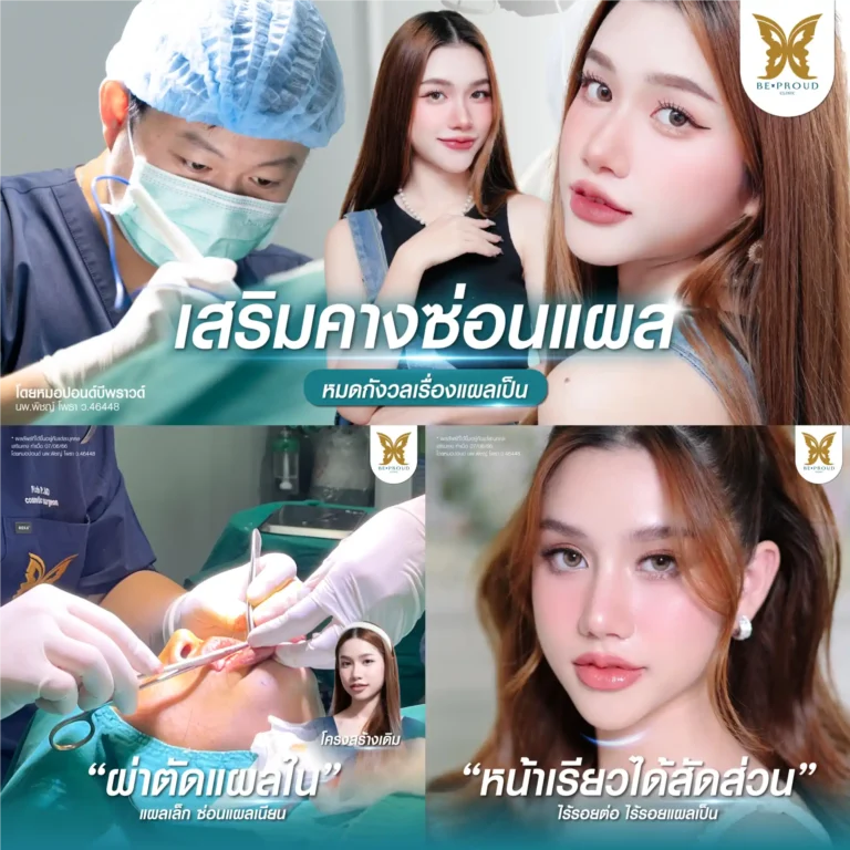 รีวิวเสริมคางซ่อนแผล (แผลใน) ทรงสวยละมุน ไร้รอยแผลเป็น โดยหมอปอนด์ Beproud Clinic