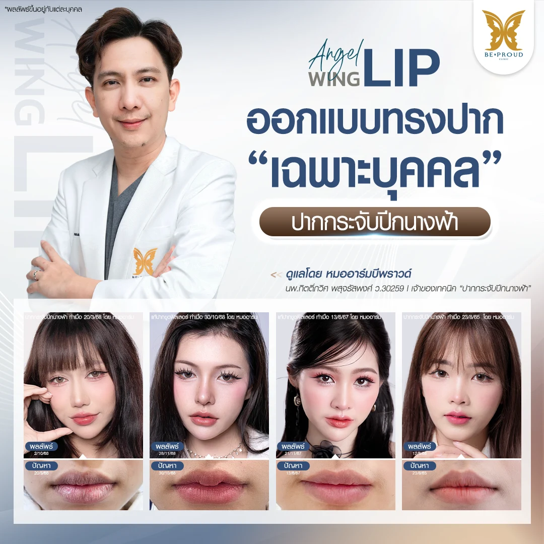 สวยปังไม่ซ้ำใคร ปากกระจับปีกนางฟ้าออกแบบทรงปากเฉพาะบุคคล โดยหมออาร์ม บีพราวด์ คลินิก เจ้าของเทคนิค ปากกระจับปีกนางฟ้า
