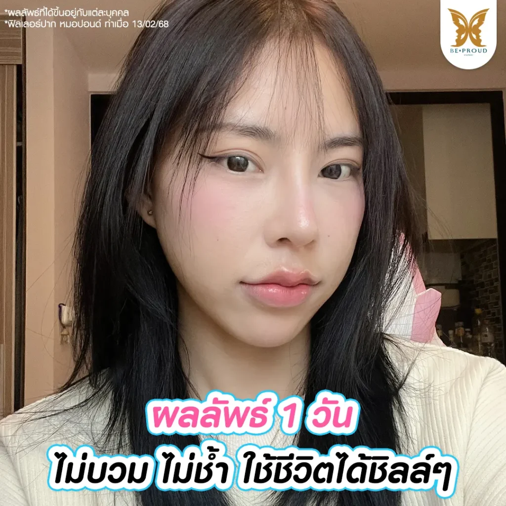 โปรแกรมฟิลเลอร์ เคล็ดลับความสวยของน้องมีมี่ทำโปรแกรมฟิลเลอร์ต้องบีพราวด์เท่านั้น !!