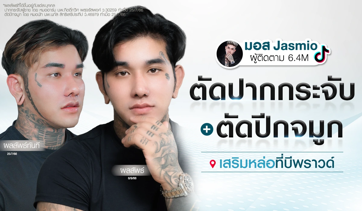 รีวิวผลลัพธ์การตัดปากกระจับและตัดปีกจมูก มอส Jasmio เสริมหล่อที่บีพราวด์ ทรงแมนๆ ไม่โป๊ะ เปลี่ยนลุคเข้มเป็นหล่อซอฟต์