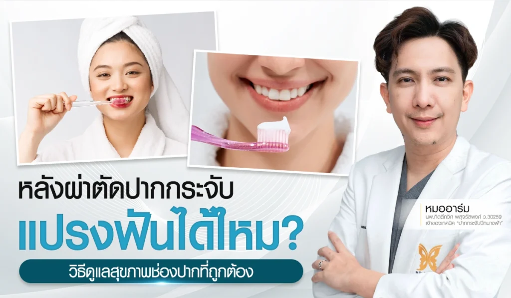 วิธีทำความสะอาดฟันหลังผ่าตัดศัลยกรรมปากกระจับ 1-3 วันแรกต้องดูแลยังไง แปรงฟันได้ไหม? วิธีดูแลสุขภาพช่องปากที่ถูกต้อง โดยหมออาร์ม Beproud Clinic