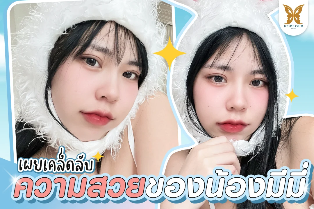 รีวิวความสวยของน้องมีมี่ ในลุคสดใส ที่ไว้วางใจทำโปรแกรมฟิลเลอร์กับหมอปอนด์ บีพราวด์ คลินิก