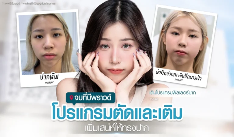 รีวิวโปรแกรมตัดและเติมริมฝีปากที่ Beproud Clinic คุณนิว @wichanew หลังผ่าตัดปากกระจับปีกนางฟ้า ผลลัพธ์หลังเติมโปรแกรมฟิลเลอร์ปากดูอวบอิ่มและละมุนขึ้น เพิ่มเสน่ห์ให้ทรงปาก