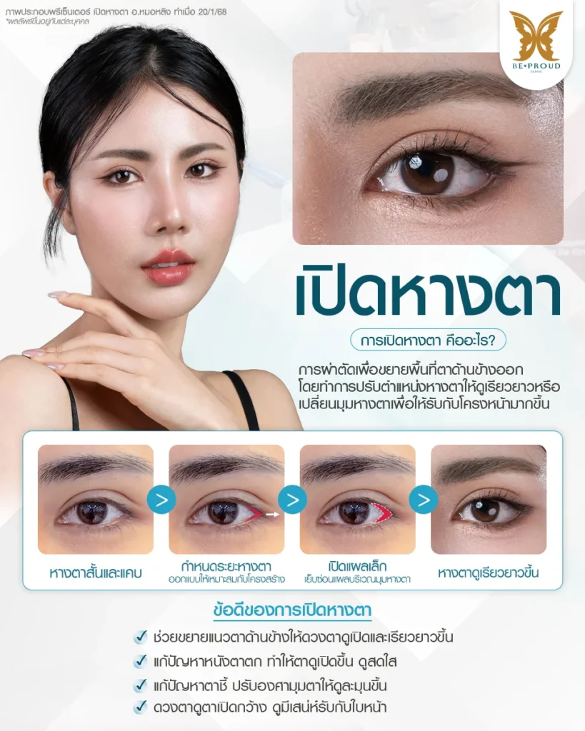 การเปิดหางตาคืออะไร? เจาะลึกขั้นตอนและข้อดี ปรับรูปตาเรียวยาวมีมิติ