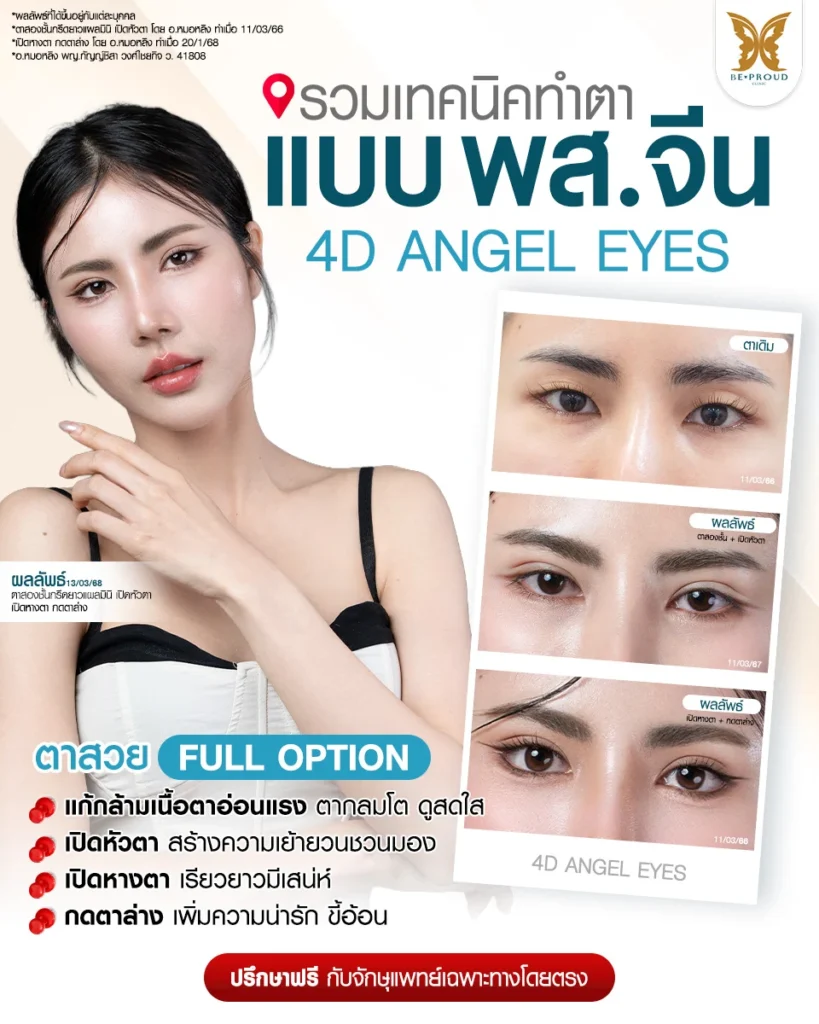 รวมเทคนิคทำตาแบบ พส.จีน 4D ANGEL EYES ตาสวย Full Option ครบจบในที่เดียว