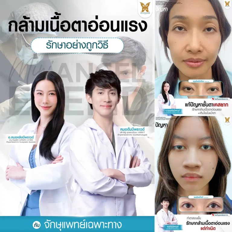 แก้กล้ามเนื้อตาอ่อนแรง ตาสองชั้นแก้กล้ามเนื้อตาอ่อนแรง เปลี่ยนการมองเห็นในทุกเช้าให้ไม่เหมือนเดิม