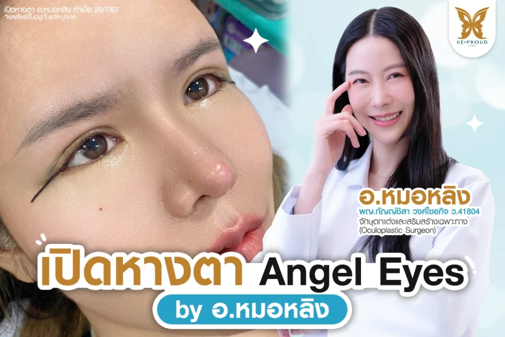 เปิดหางตา Angel Eyes เทคนิคปรับรูปตาเรียวยาวสไตล์ พส.จีน โดย อ.หมอหลิง