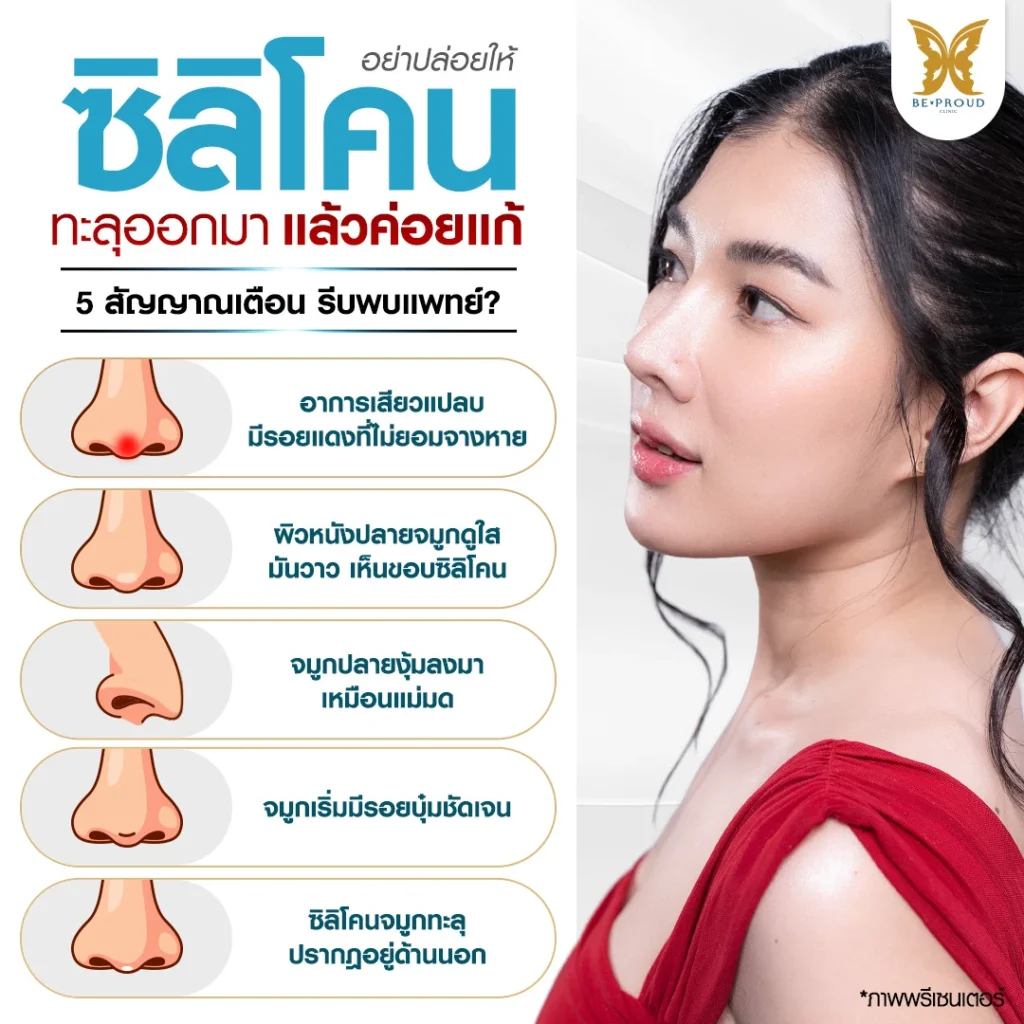 จมูกทะลุ ดูยังไง? สรุป 5 สัญญาณเตือนที่ต้องรีบพบแพทย์ อย่ารอให้สายเกินแก้