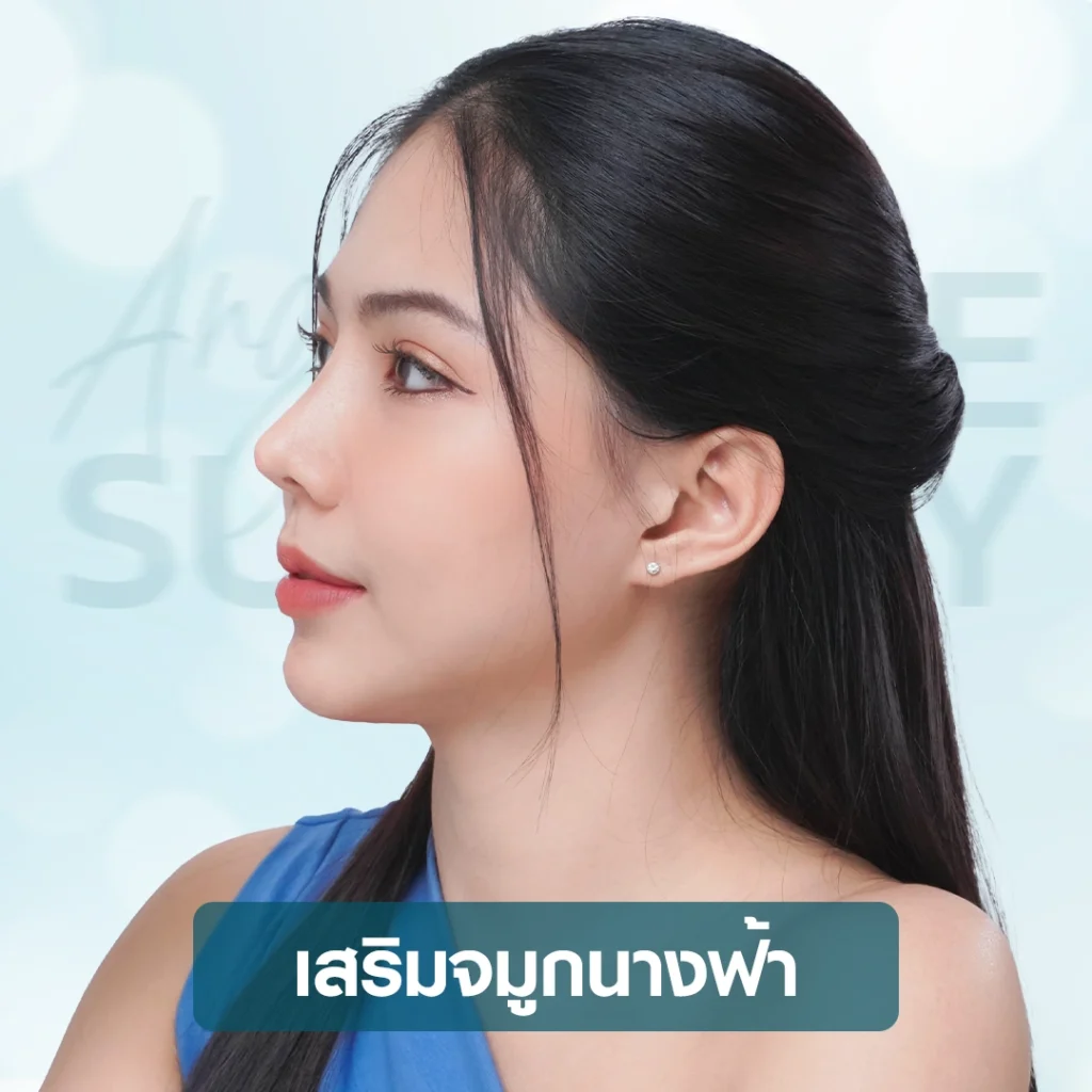 โปรโมชั่น เสริมจมูก Slope Angel บริการเสริมจมูกนางฟ้า บีพราวด์ คลินิก rhinoplasty Beproud Clinic
