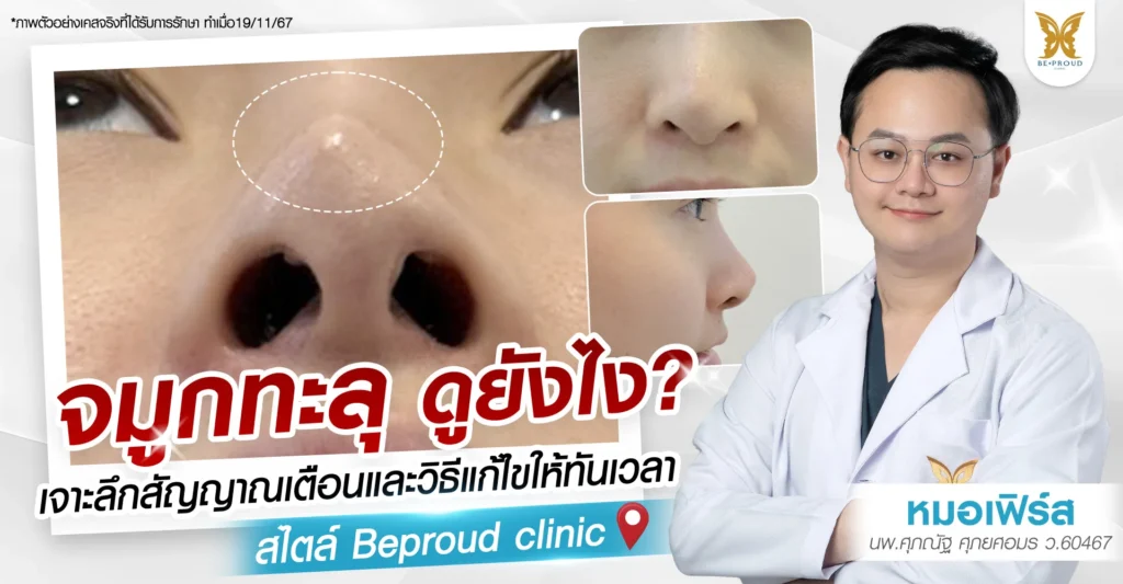 จมูกทะลุ ดูยังไง? เจาะลึก 5 สัญญาณเตือนและวิธีแก้ไขโดยหมอเฟิร์ส Beproud Clinic