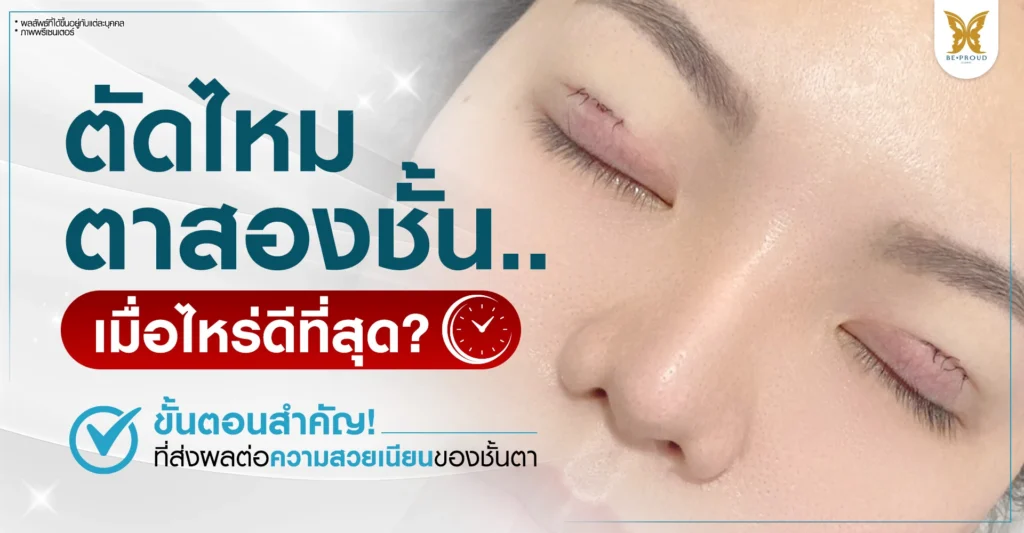 ตัดไหมตาสองชั้น เมื่อไหร่ดีที่สุด? ขั้นตอนสำคัญเพื่อชั้นตาสวยเนียน สไตล์ Beproud Clinic