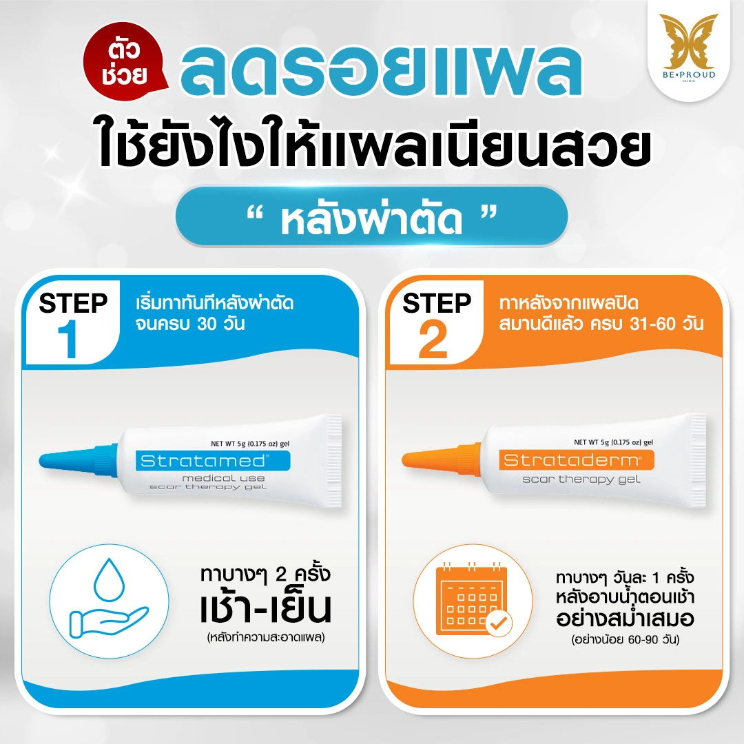 สเต็ปทายาลดรอยแผลศัลยกรรมตาให้เนียนสวย วิธีใช้ Stratamed และ Strataderm