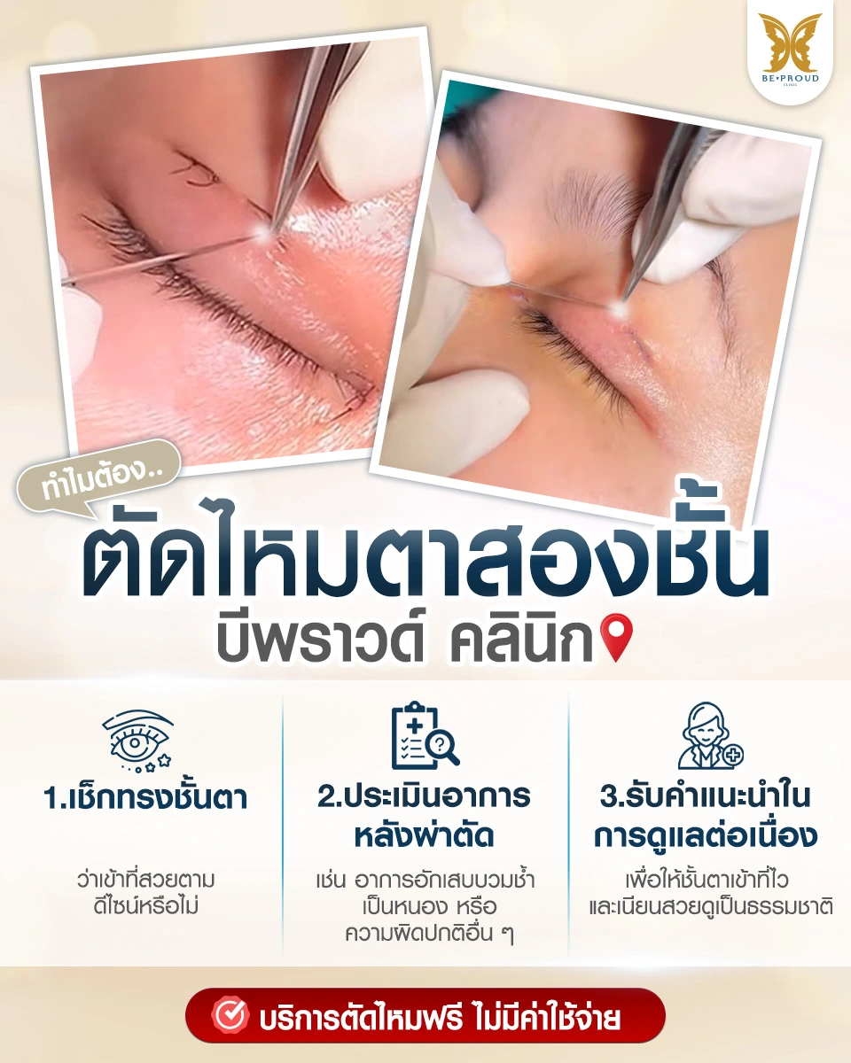 ทำไมต้องตัดไหมตาสองชั้นที่ Beproud Clinic? เช็กแผลฟรี ดูแลครบจบ