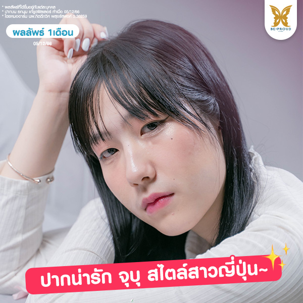 รีวิวเคสศัลยกรรมปากกระจับปีกนางฟ้าของคุณฟา มาริโมะ ผลลัพธ์ 1 เดือนผลลัพธ์ที่ได้คือทรงปากกระจับที่เข้าที่ ดูละมุน เป็นธรรมชาติ โดย หมออาร์ม (นพ.กิตติ์ภวิศ พสุจรัสพงศ์)