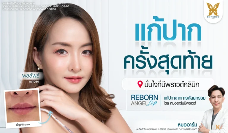รีวิวแก้ปากกระจับ คุณภัทร เทคนิค Reborn Angel Lip โดยหมออาร์ม Beproud Clinic แก้ปากบางเลาะพังผืด คืนทรงปากสวยละมุน