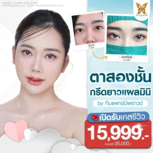 โปรโมชั่นศัลยกรรม ตาสองชั้นกรีดยาวแผลมินิ บีพราวด์