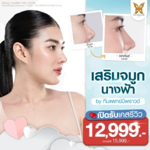 ภาพโปรโมชั่นศัลยกรรมเสริมจมูกนางฟ้าราคาพิเศษสำหรับเคสรีวิว ที่บีพราวด์คลินิก แสดงภาพตัวอย่างเคสลูกค้าเสริมจมูก รีวิวเปรียบเทียบก่อน-หลังทำศัลยกรรมจมูก