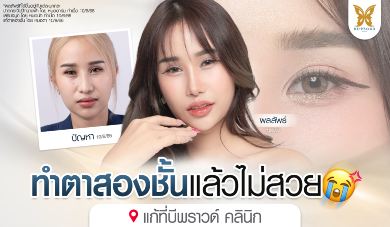 ภาพปัญหาก่อนแก้ตาสองชั้น เบ้าตาลึก ตาสามชั้น หัวตาปิด หมอดา Beproud Clinic