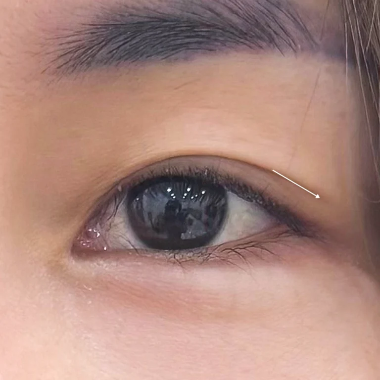 หางตาตก-หางตาชี้