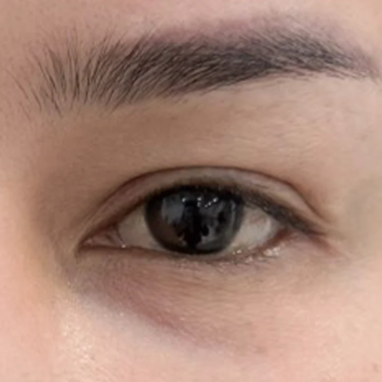 ดวงตาไม่สมดุลกับใบหน้า