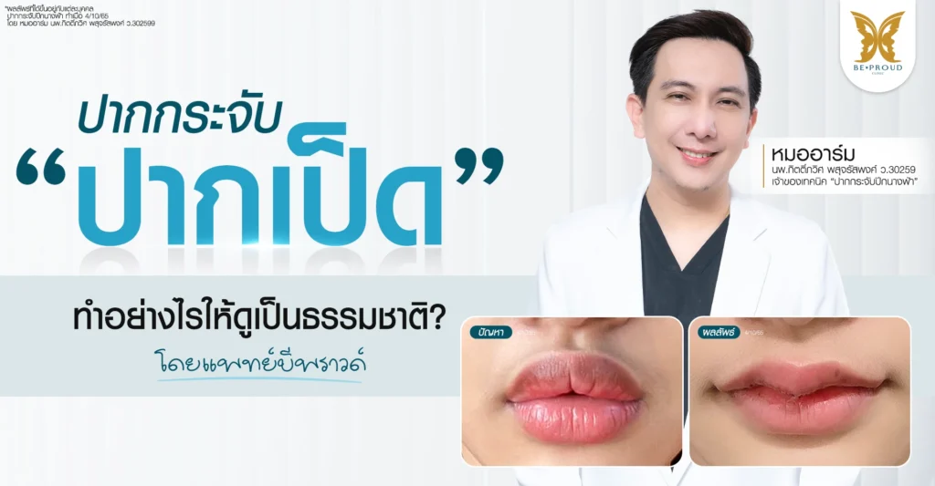 ปากกระจับ ปากเป็ด ทำอย่างไรให้ดูเป็นธรรมชาติ โดยแพทย์บีพราวด์ ปากกระจับ ปากเป็ด ทำอย่างไรให้ดูเป็นธรรมชาติ ปัญหา ปากหนา ปากใหญ่ จนดูคล้ายลักษณะปากของเป็ โดย แพทย์บีพราวด์