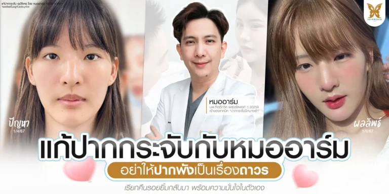 รีวิวแก้ปากกระจับปีกนางฟ้า ปรับรูปปากผิดรูปจากอุบัติเหตุ หมออาร์ม Beproud Clinic