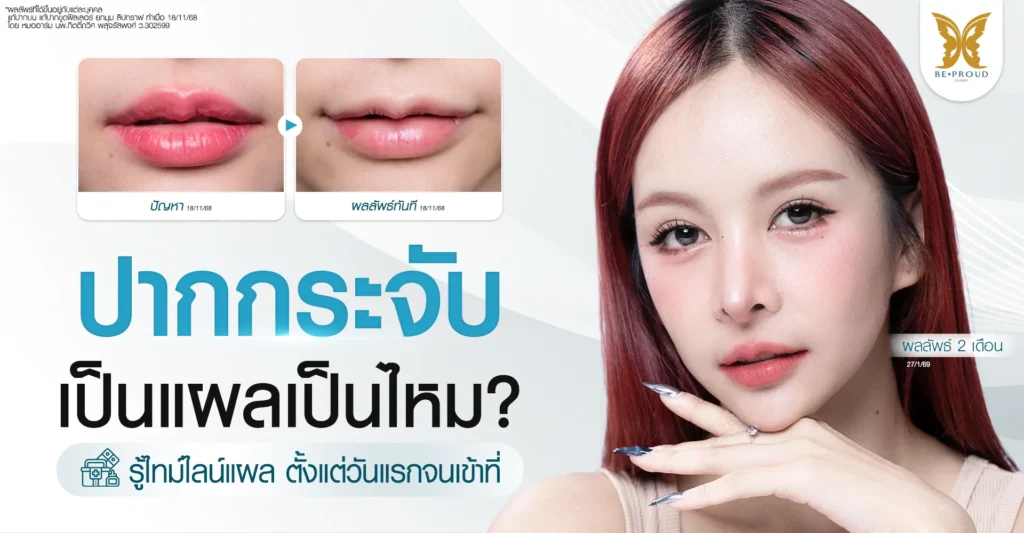 ปากกระจับ เป็นแผลเป็นไหม? รู้ไทม์ไลน์แผล ตั้งแต่วันแรกจนเข้าที่ ปากกระจับ เป็นแผลเป็นไหม เทคนิคการผ่าตัด ซ่อนรอยแผล ที่ Beproud Clinic