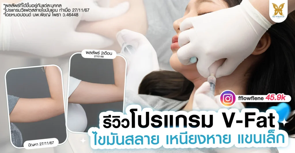 ภาพรีวิวฉีดแฟตสลายไขมัน โปรแกรม V-Fat แฟตเหนียงและต้นแขน น้องโฟร์ โดยหมอปอนด์ Beproud Clinic เหนียงหาย แขนกระชับ
