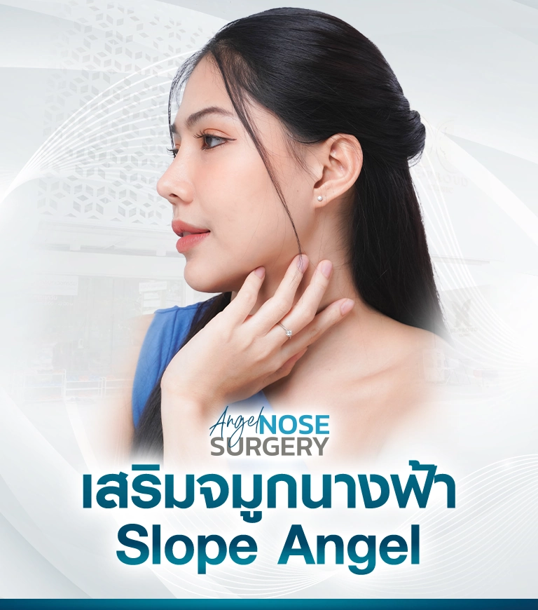 รีวิวเสริมจมูกนางฟ้า Slope Angel สวยละมุน Beproud Clinic เสริมจมูกนางฟ้าเทคนิค Slope Angel โดยทีมแพทย์ผู้เชี่ยวชาญ Beproud Clinic