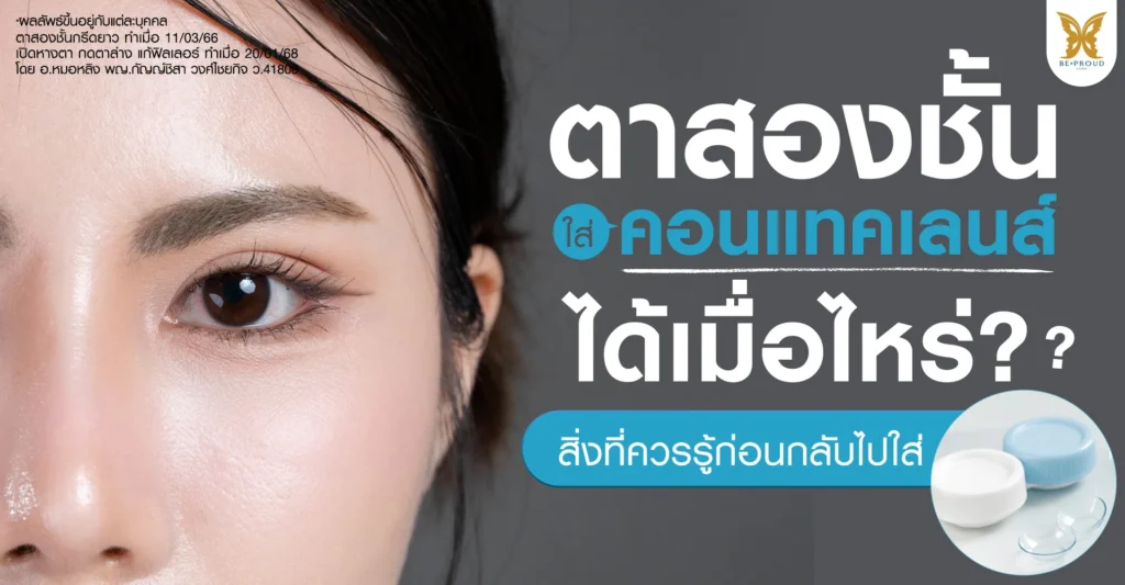 ตาสองชั้น ใส่คอนแทคเลนส์ ได้เมื่อไหร่? สิ่งที่ควรรู้ก่อนกลับไปใส่ ตาสองชั้นตาสองชั้นใส่คอนแทคเลนส์ได้เมื่อไหร่