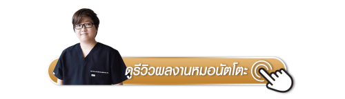 ดูรีวิวผลงานหมอนัตโตะเพิ่มเติม